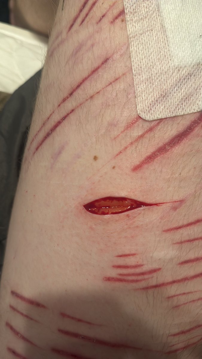 quzooi ❤️🩹 tweet media