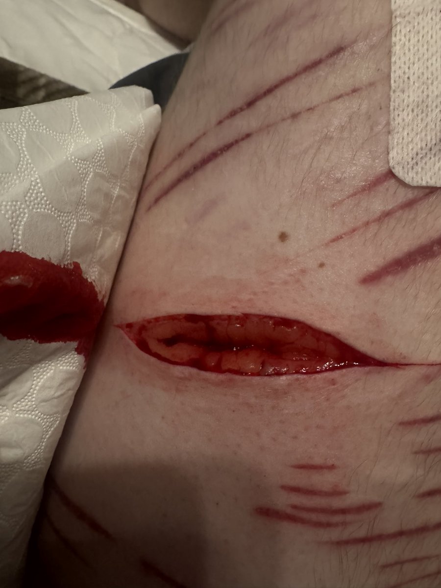 quzooi ❤️🩹 tweet media