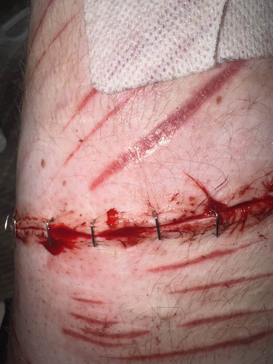 quzooi ❤️🩹 tweet media