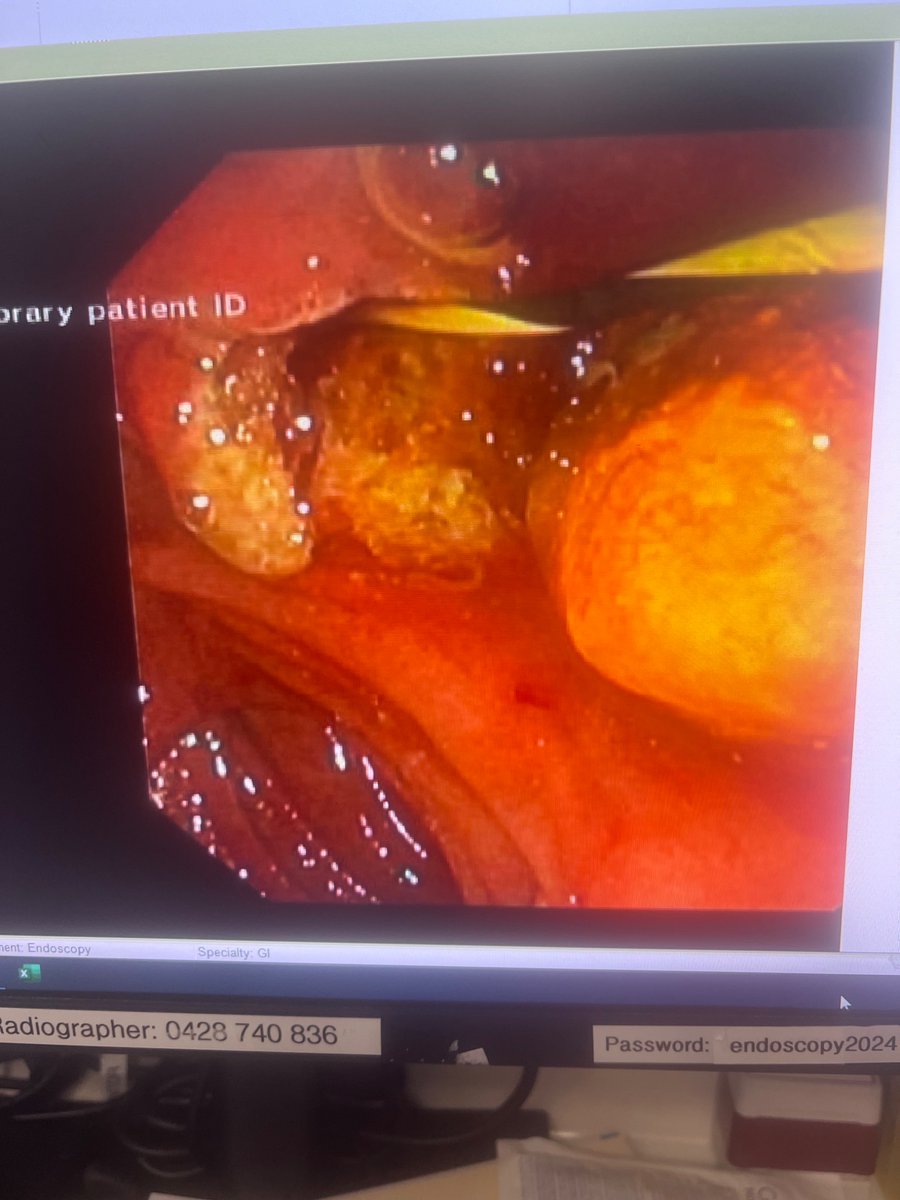 Puneet Chhabra tweet media