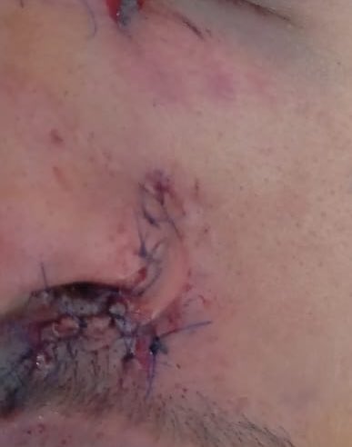 Foreign body tweet media