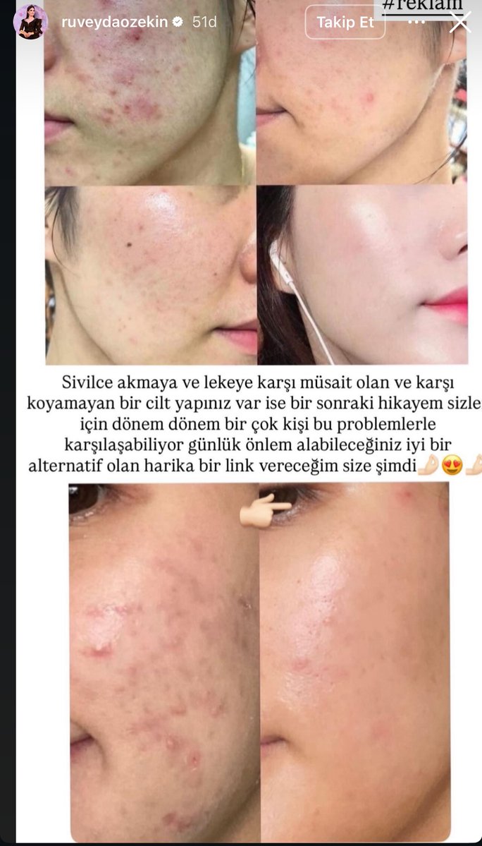 Alp Kılınç tweet media