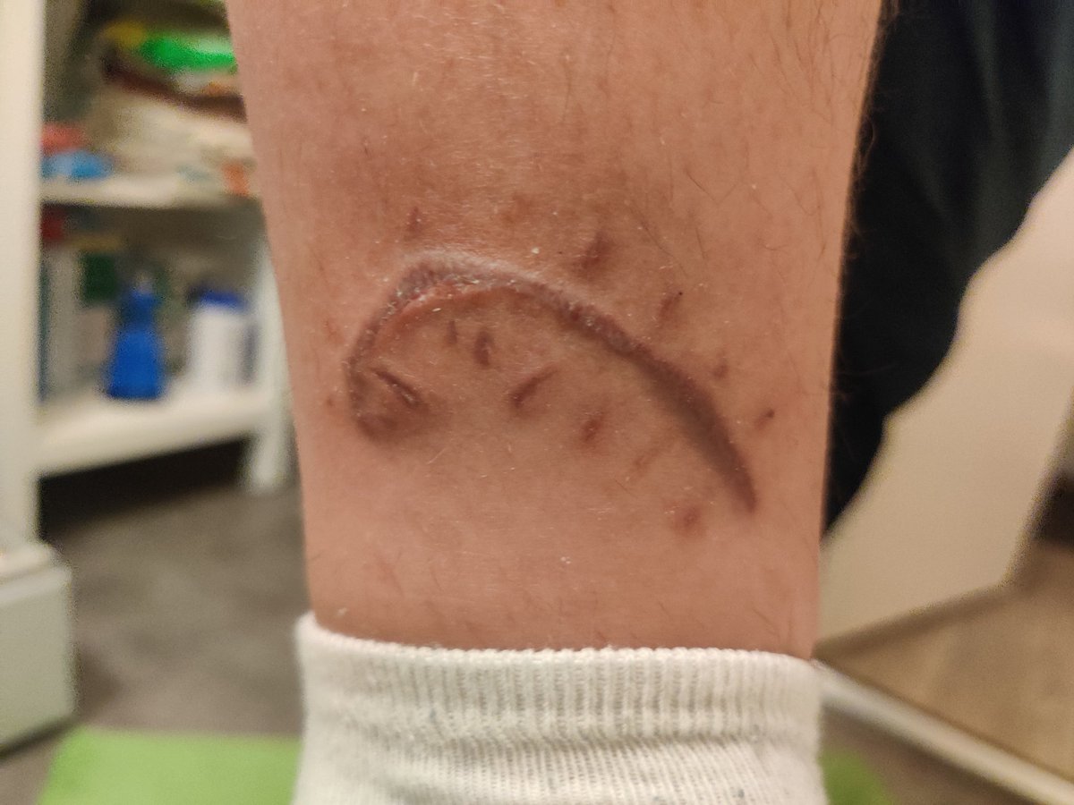 HeartFire 💌🏹 tweet media