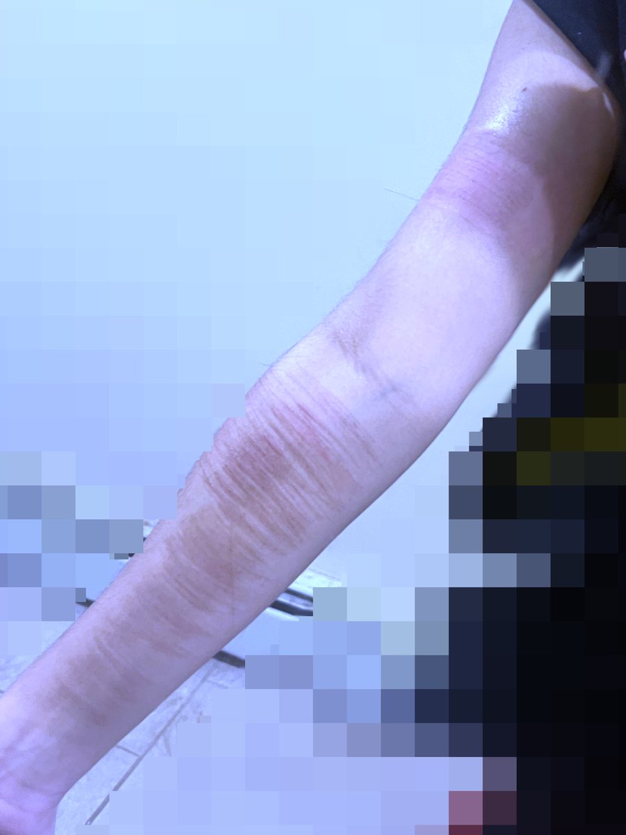 loser of 988&shtwt tweet media