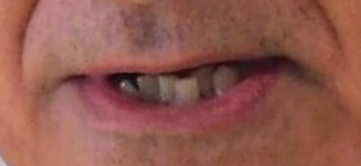 Kermit Forever tweet media