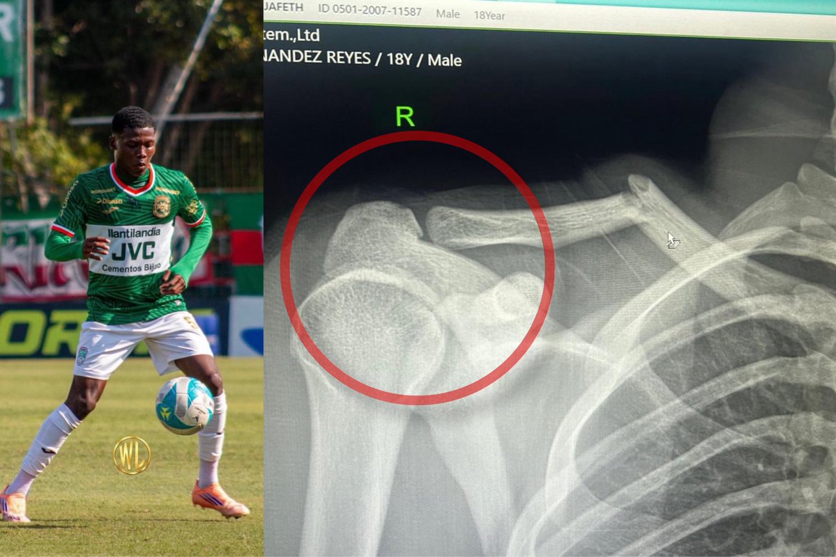 Jafeth Moreno tweet media