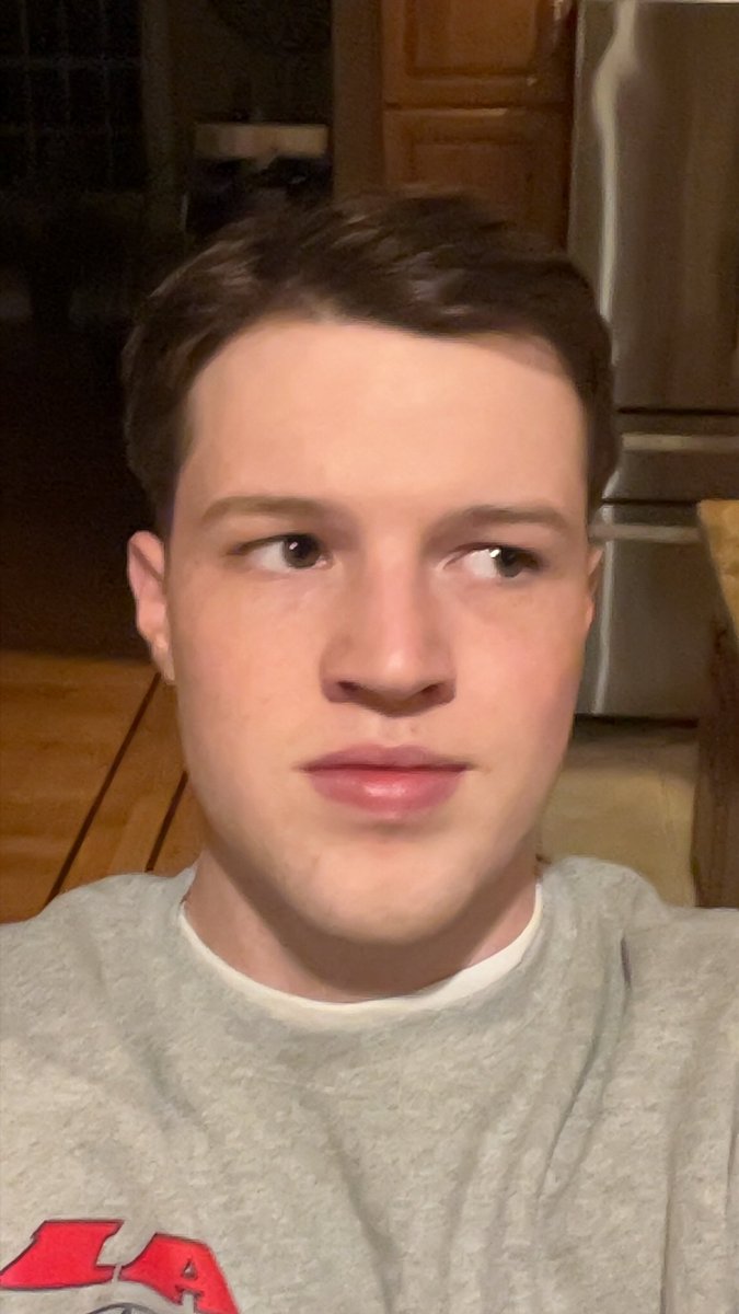 bald matty tweet media