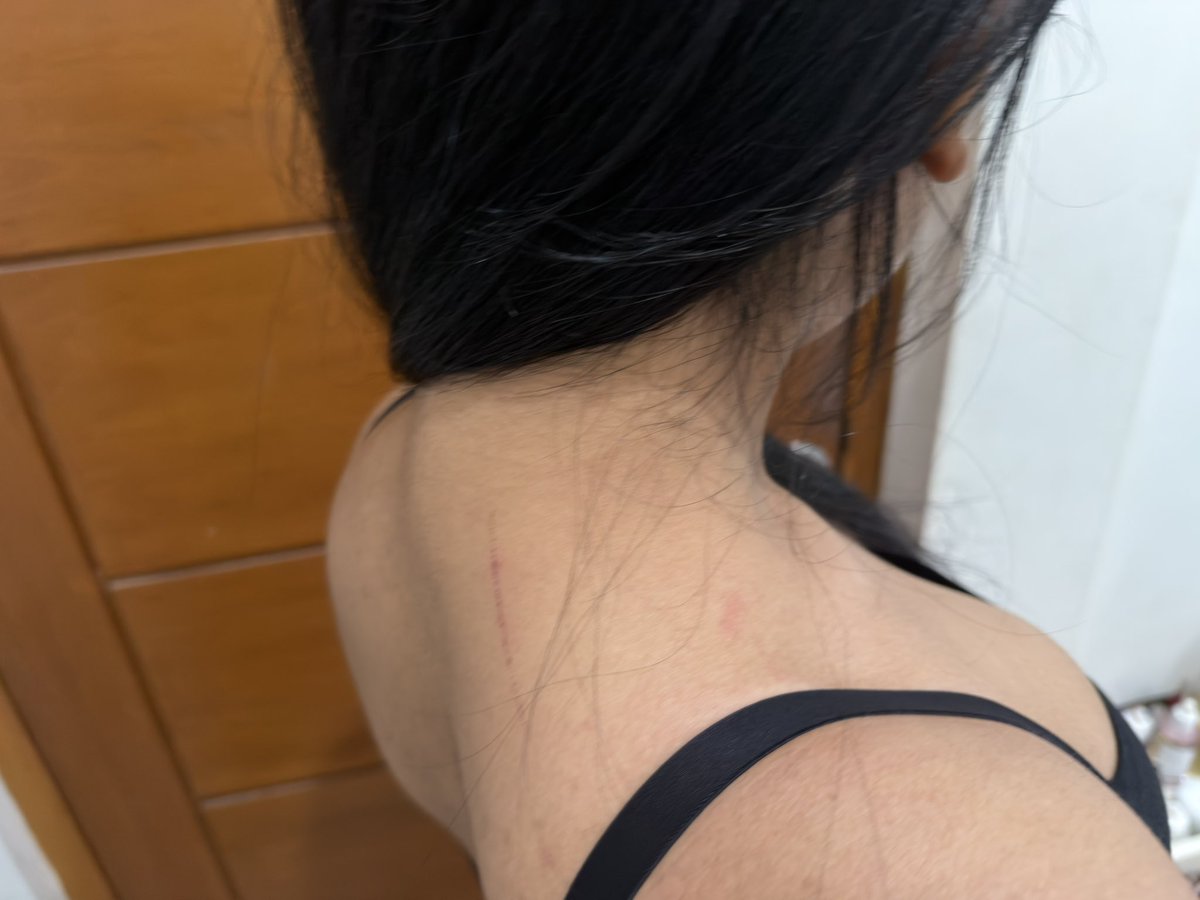 ๐๐ง๐ง ๐บ tweet media