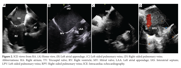 Brain & Heart - ASP tweet media