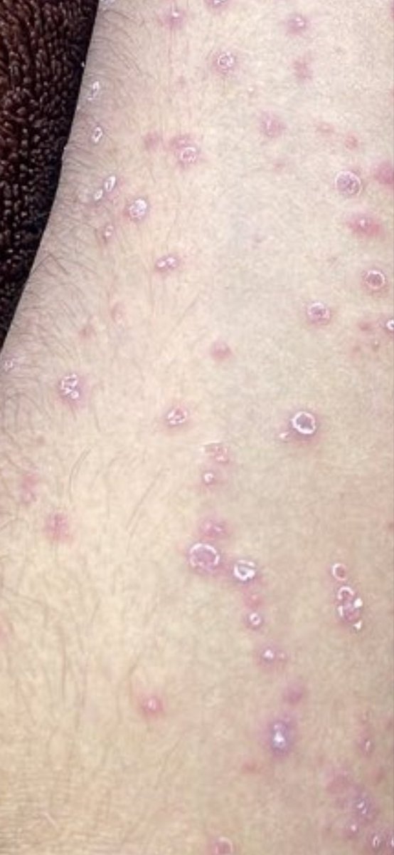 Ralf B. Lukner MD PhD tweet media