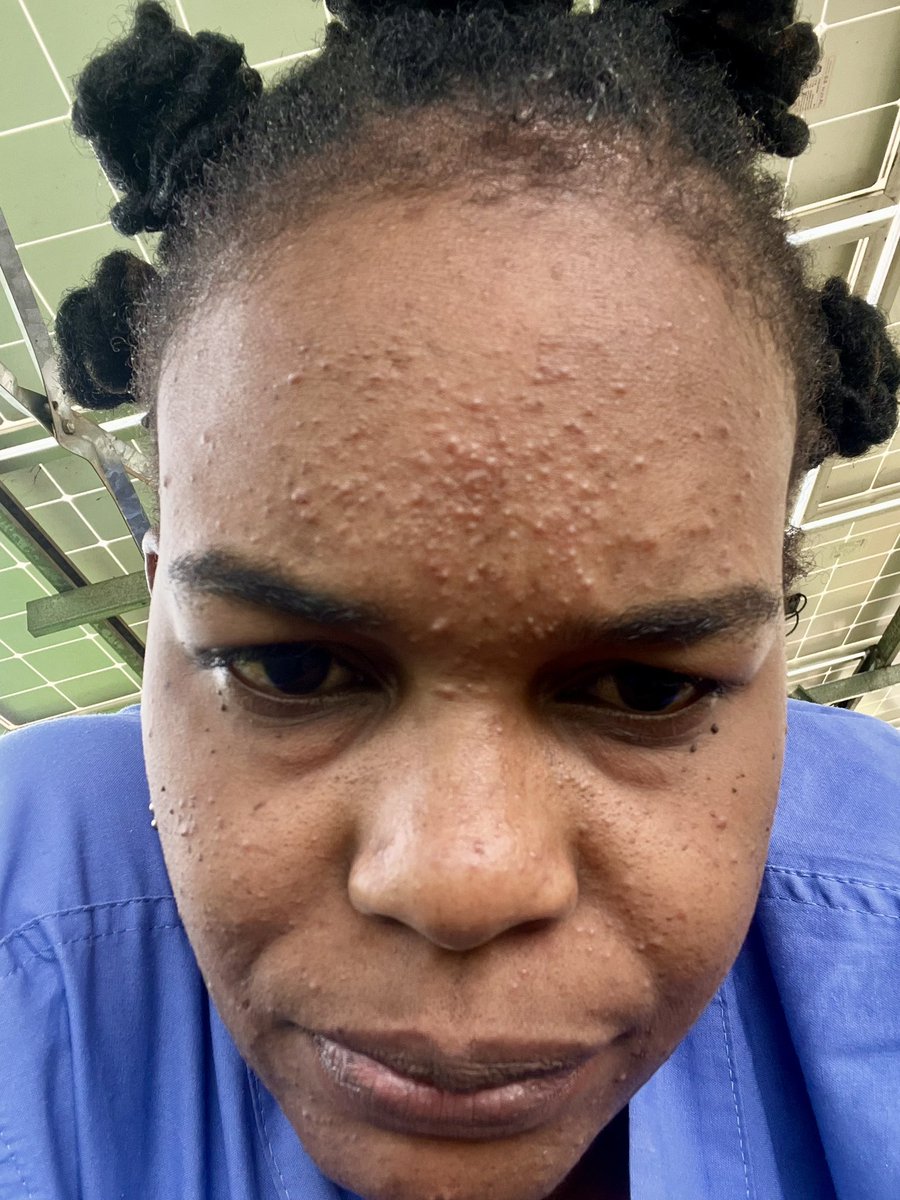 Humble♡Bee🐝 tweet media