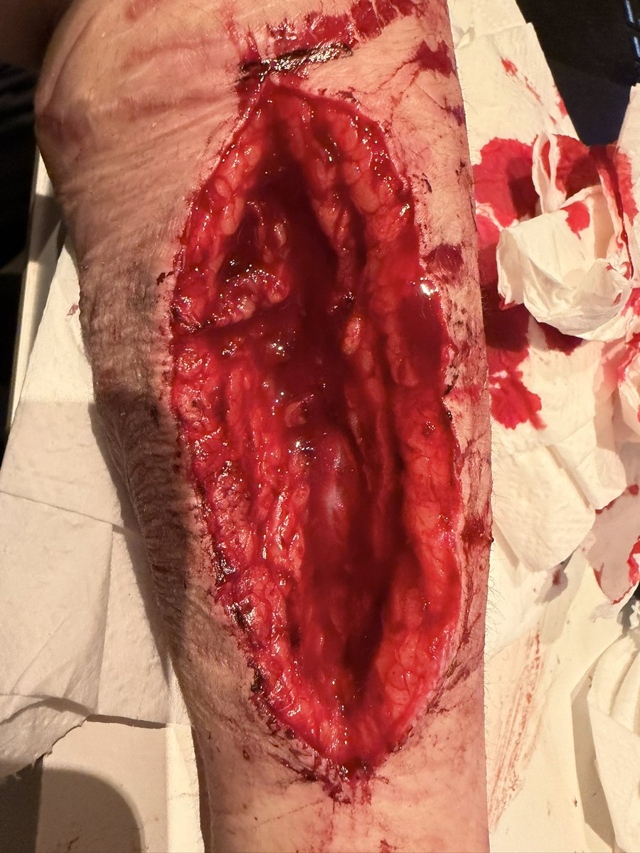 Minesweeper of shtwt tweet media