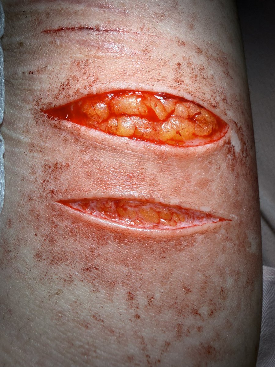 ✧ ⦻ Mori .ᐟ #shedtwt tweet media