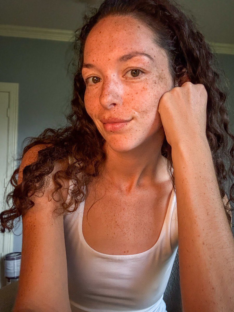 Dr. Emma Hall tweet media