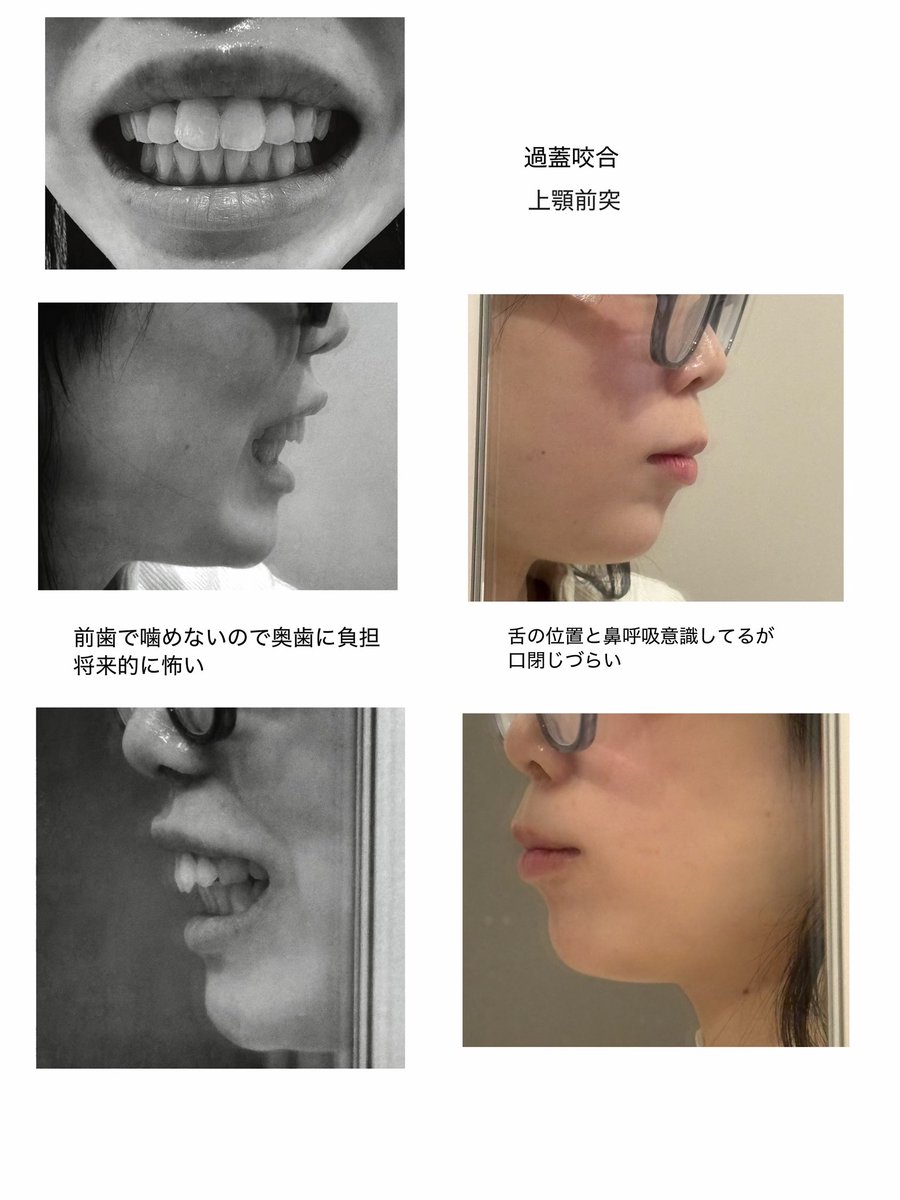 なあち tweet media