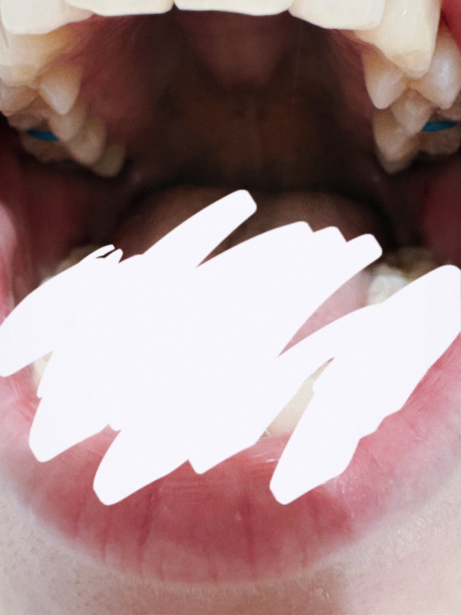 なあち tweet media