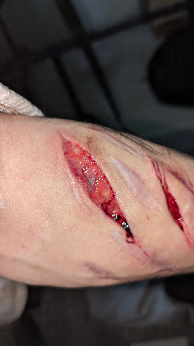 utilityknife - 🇫🇮 - shedtwt tweet media