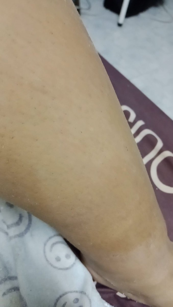 น้องส้ม&แซนดี้ tweet media