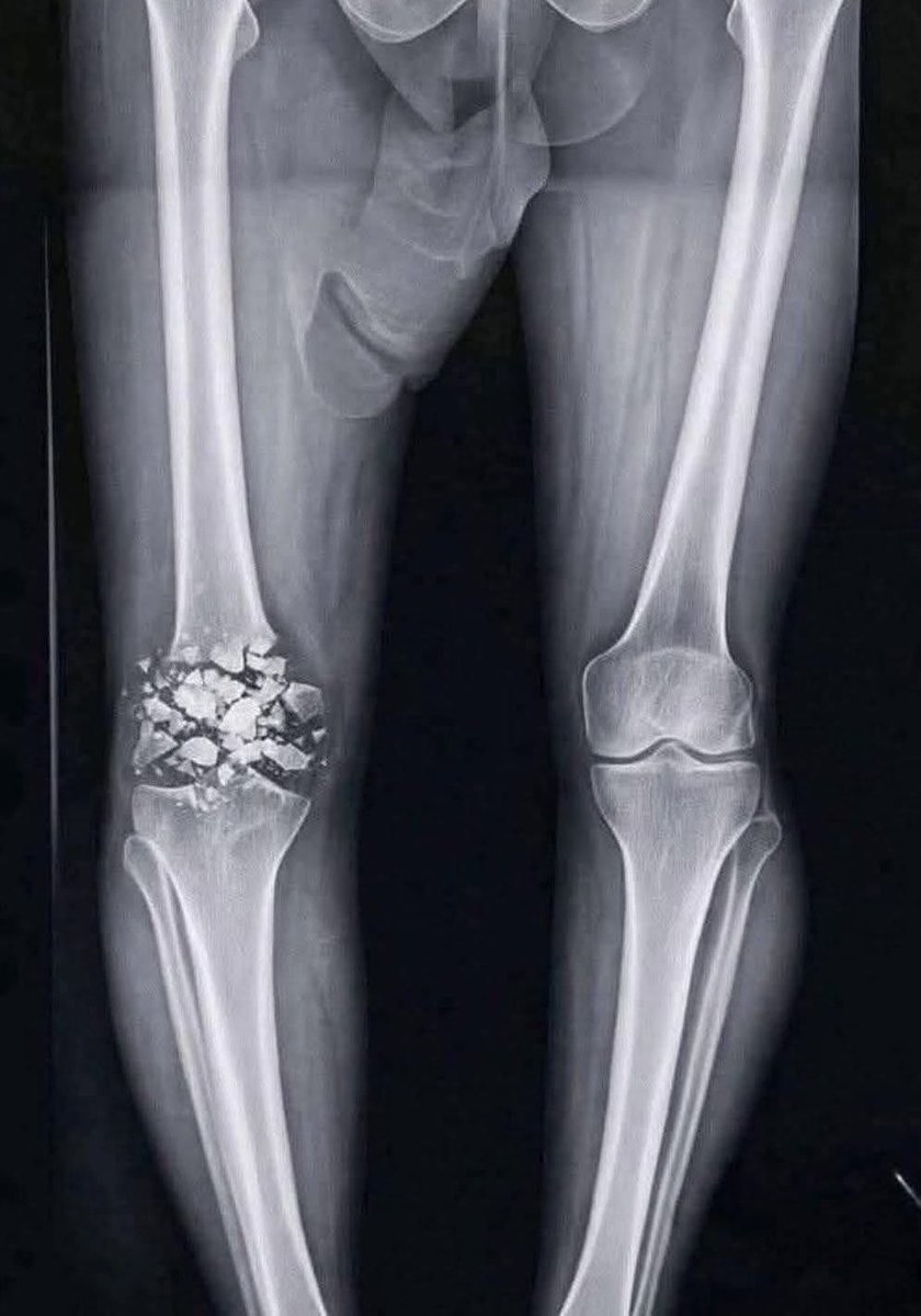 ØTöNGKØiL tweet media