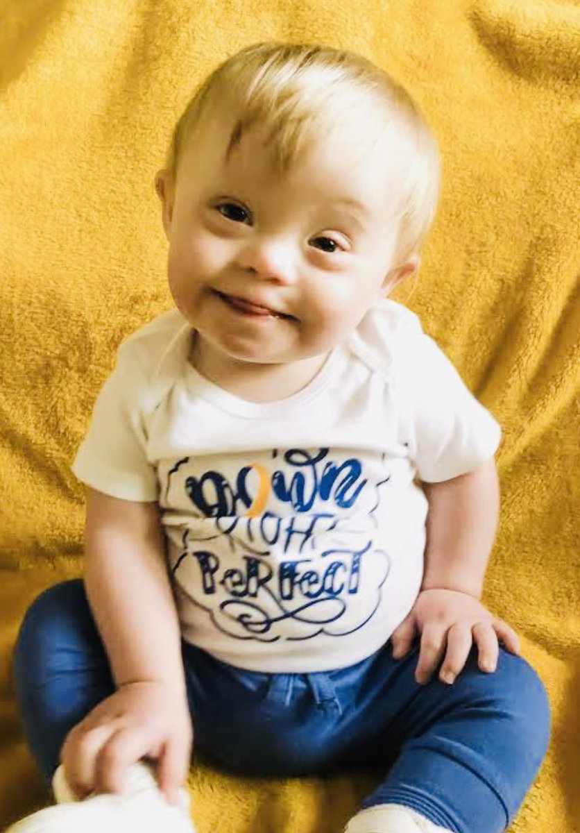 Alycespeechie's tweet image. Know some facts about Down Syndrome
Before you say the mother was old or people with Down Syndrome are slow to understand things‼️
#downsyndrome #speechtherapy