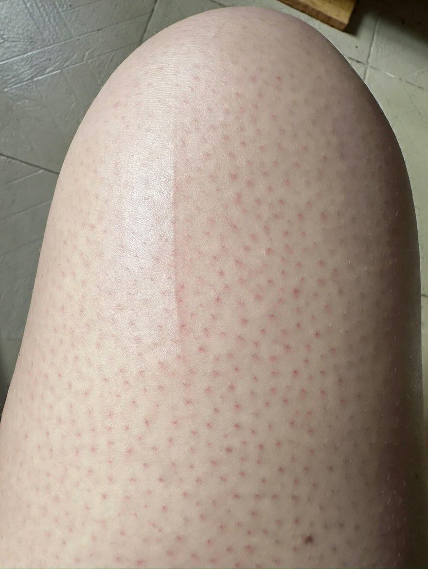 𝕋ⒶℍⒶ🔝 tweet media