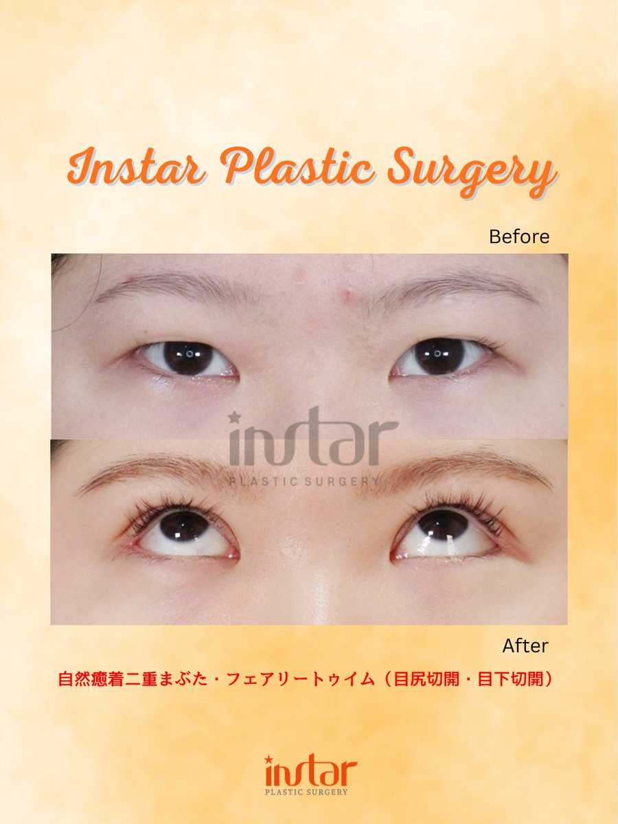 ⭐️instar整形外科⭐️ tweet media