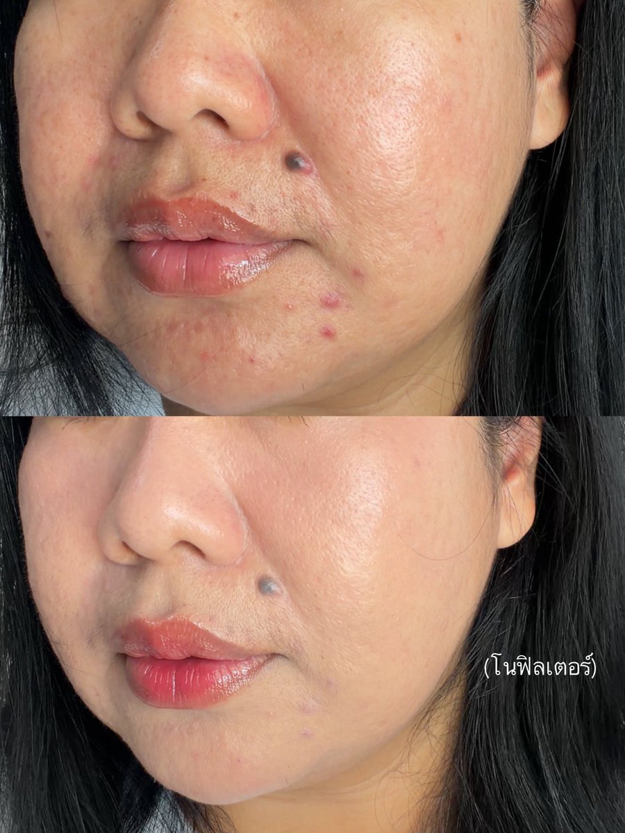 น้อลเหนียง ꔛ 🎄 ¹ ⁴ ⁵ tweet media