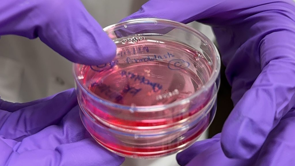 Lifespan tweet media