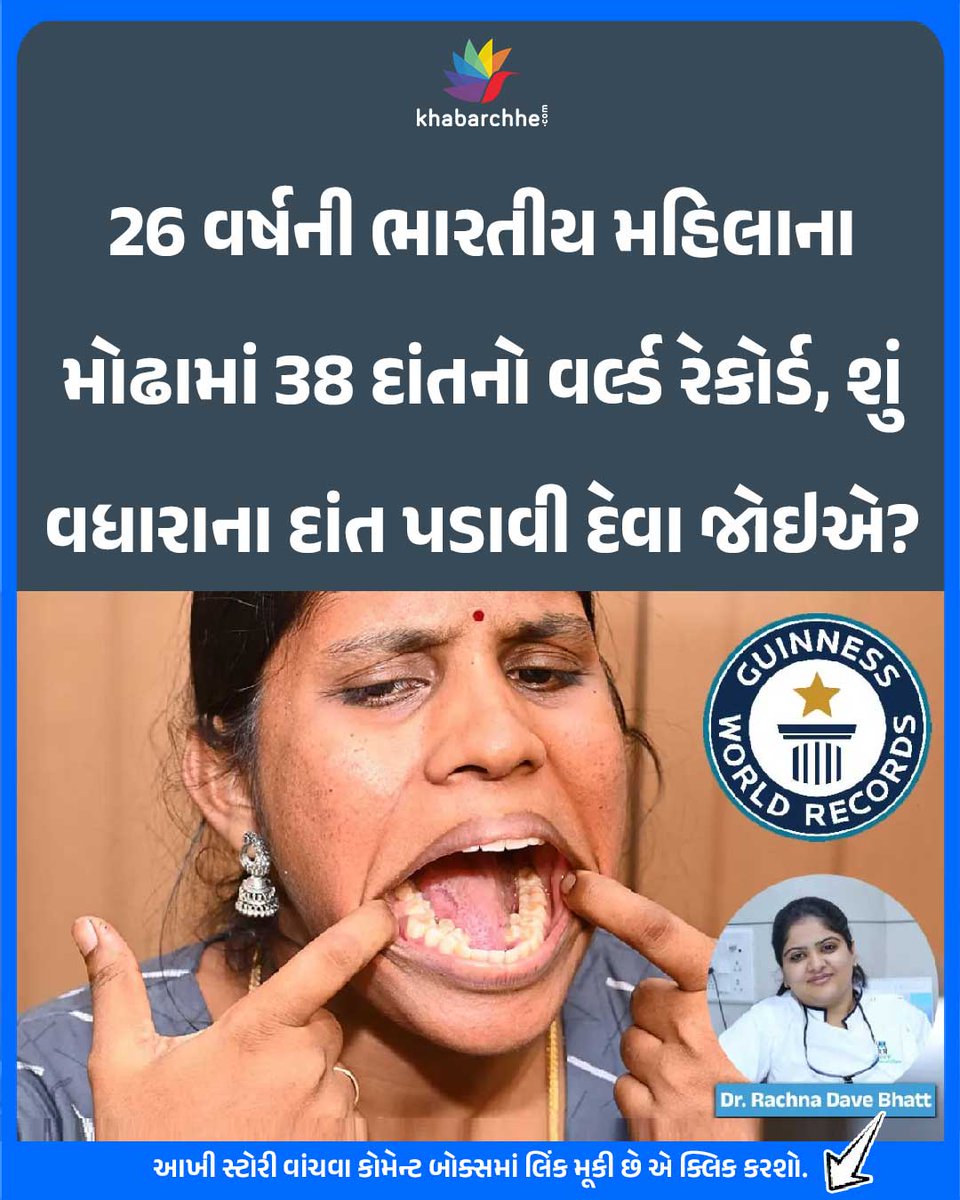 khabarchhe's tweet image. 26 વર્ષની ભારતીય મહિલાના મોઢામાં 38 દાંતનો વર્લ્ડ રેકોર્ડ, શું વધારાના દાંત પડાવી દેવા જોઇએ?
આખી સ્ટોરી વાંચવા કોમેન્ટ બોક્સમાં લિંક મૂકી છે એ ક્લિક કરશો.
#teeth #dental #dentalcare #GuinnessWorldRecord