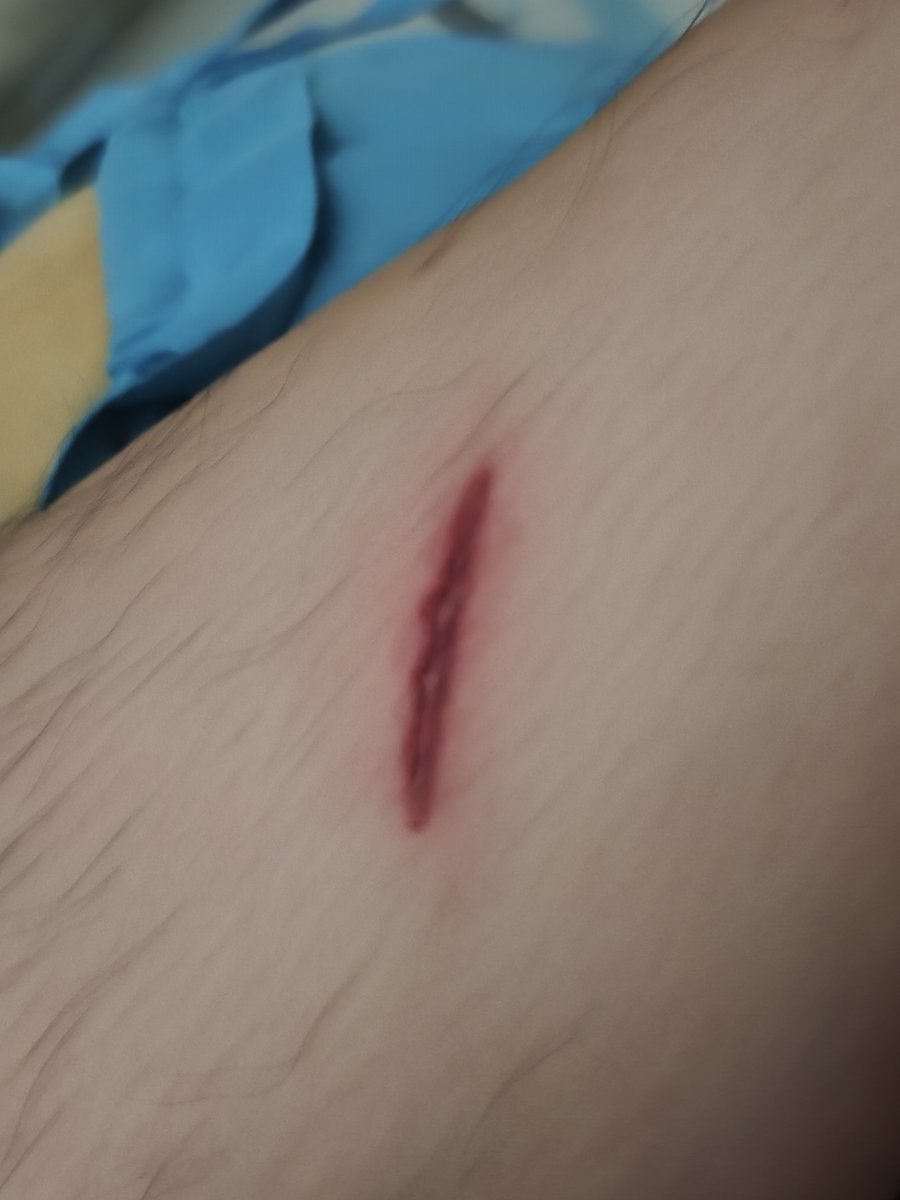 Stryker GGG J tweet media