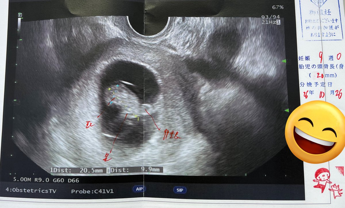 384@お休み期間 tweet media