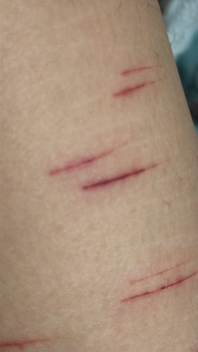 Michael Kaiser of shedtwt tweet media