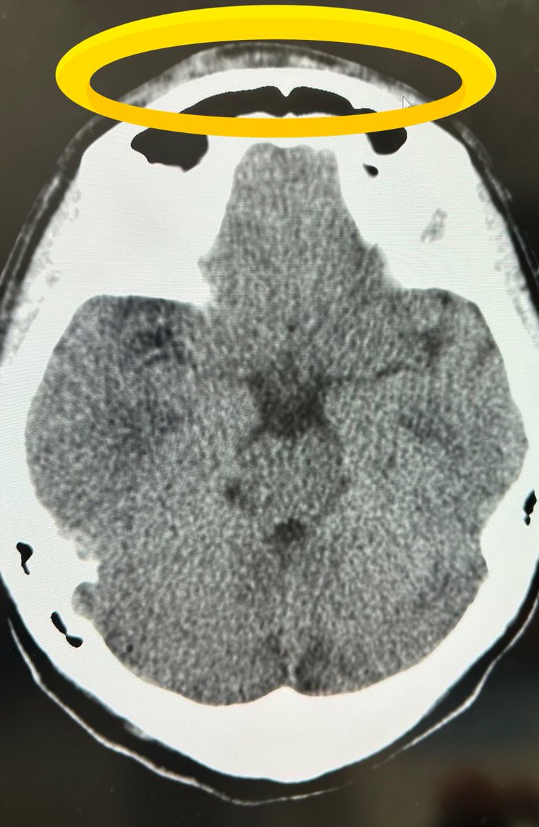 山家 七恵【はみ】Nanae Yamaka tweet media