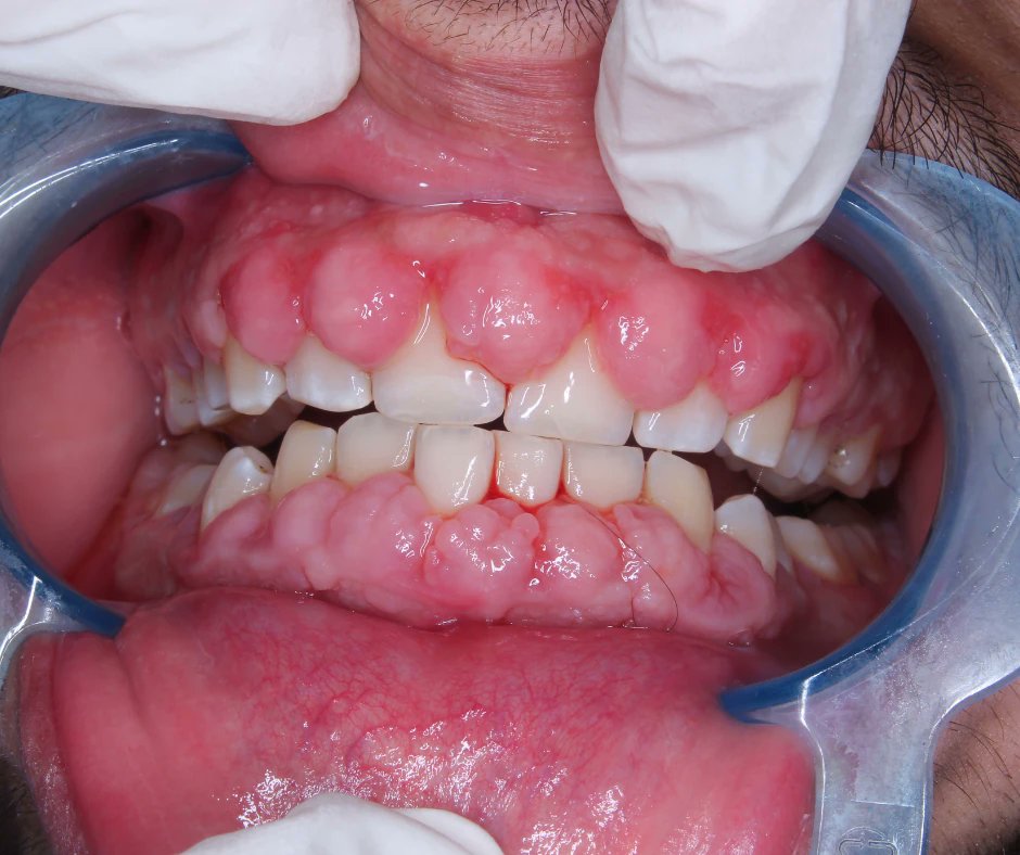 Dr Abdul Hameed 🩺 tweet media