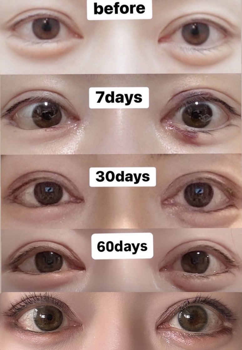 マドンソ子 tweet media