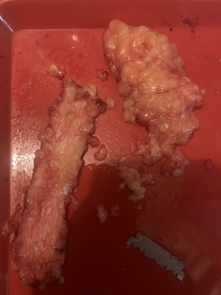 🦴 ELIJAH ⛧ -16 DNI. 🚫 tweet media