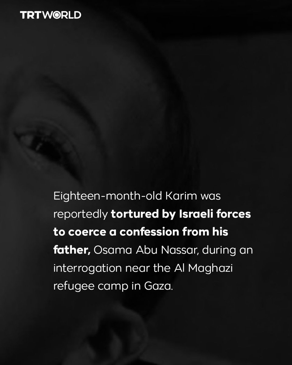 trtworld's tweet photo. Israeli forces tortured a one-year-old Palestinian child to force a confession from his father during an interrogation in Gaza, per Palestine TV.

The infant was released after 10 hours with cigarette burns and puncture wounds while the father remains in Israeli detention https://t.co/zc6es33G7m