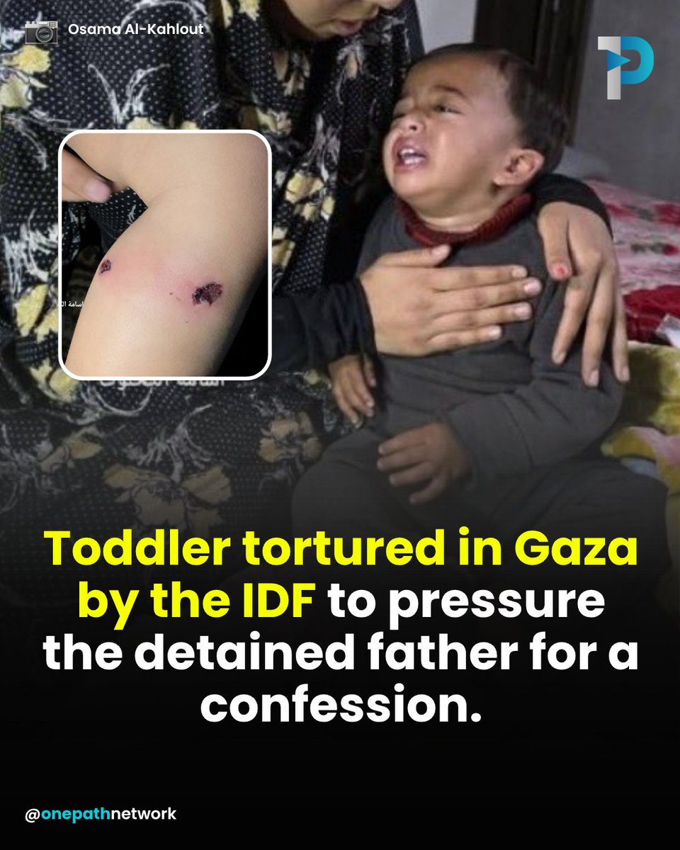FromPalestinee's tweet photo. Reports allege that Israeli soldiers brutally abused a one-year-old child in Gaza—burning his leg with a cigarette and driving a nail into it—in an attempt to force his father into confessing.
#IDFTerroristArmy 
#IsrealiPedophiles https://t.co/tbM6dAKEyZ