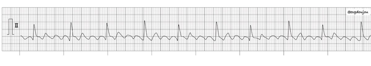 心電図道場 tweet media