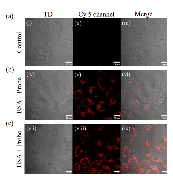ckn_lab_IIT's tweet photo. Our latest work ,"NIR emissive fluorescence turn-on probe for selective detection of serum albumin proteins in biofluids and living cells"  published in Analysis &amp; Sensing. Congratulations to Goraksha Sapkal, Abdul, Purabi and Richa on this achievement.
https://t.co/BMYoHxZTQ5 https://t.co/fmlqzE5wQ3