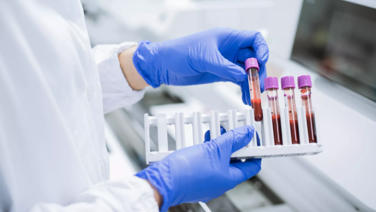 OCAILABES tweet media