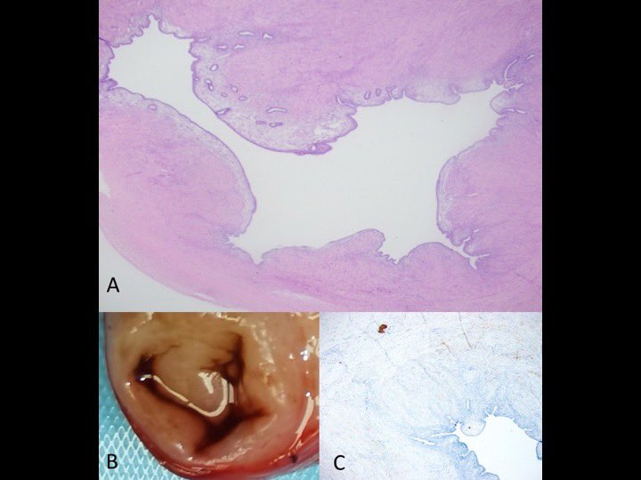 Endo Explained tweet media