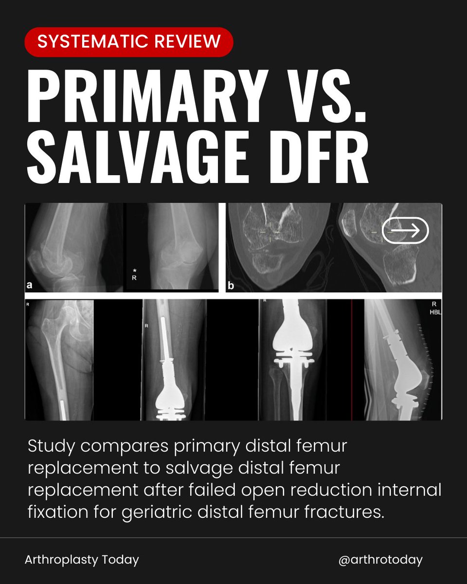 Arthroplasty Today tweet media