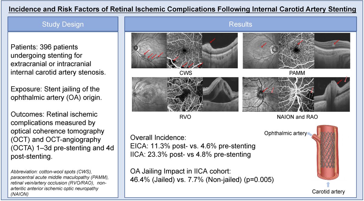 StrokeAHA_ASA's tweet photo. #Stroke Research Letter: Retinal arterial lesions are an important and underappreciated risk of carotid artery stenting. @wrkwap https://t.co/oKSs4e7WAi https://t.co/Em1JUNsyAe