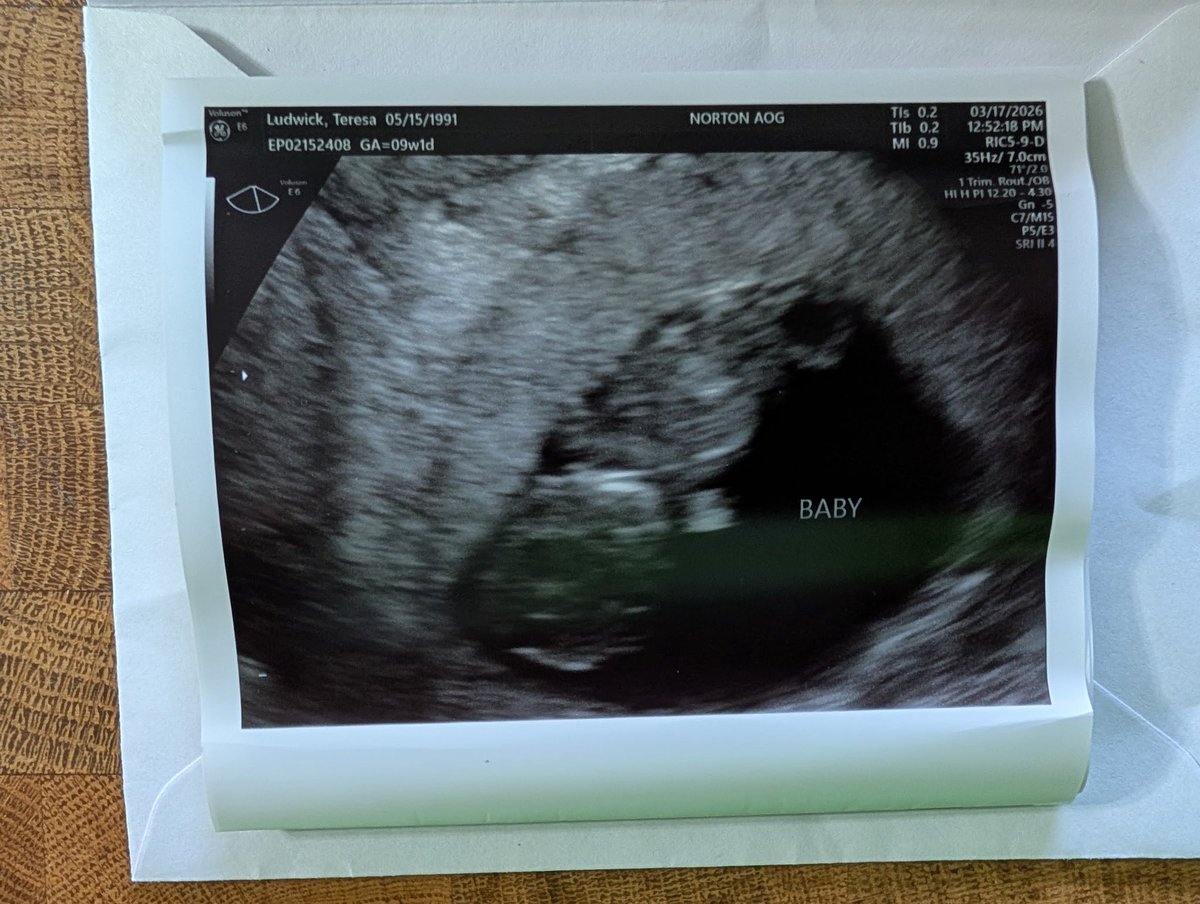 ⟭⟬ Jell-O Stan⁷⟬⟭ ⊙⊝⊜ 𝖠𝖱𝖨𝖱𝖠𝖭𝖦 March 20th tweet media