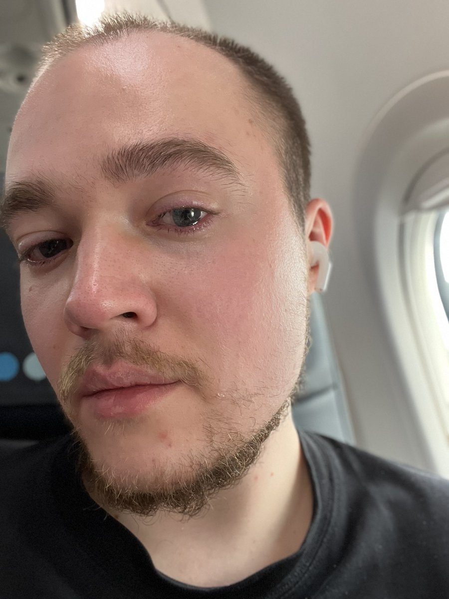 моцарелла обыкновенная tweet media