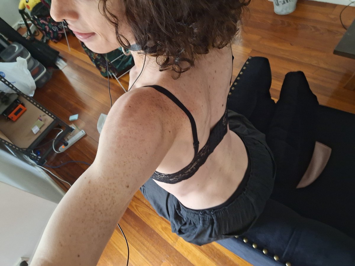 Silly Fox Girl :3 ☭🏳️‍⚧️🇵🇸 tweet media