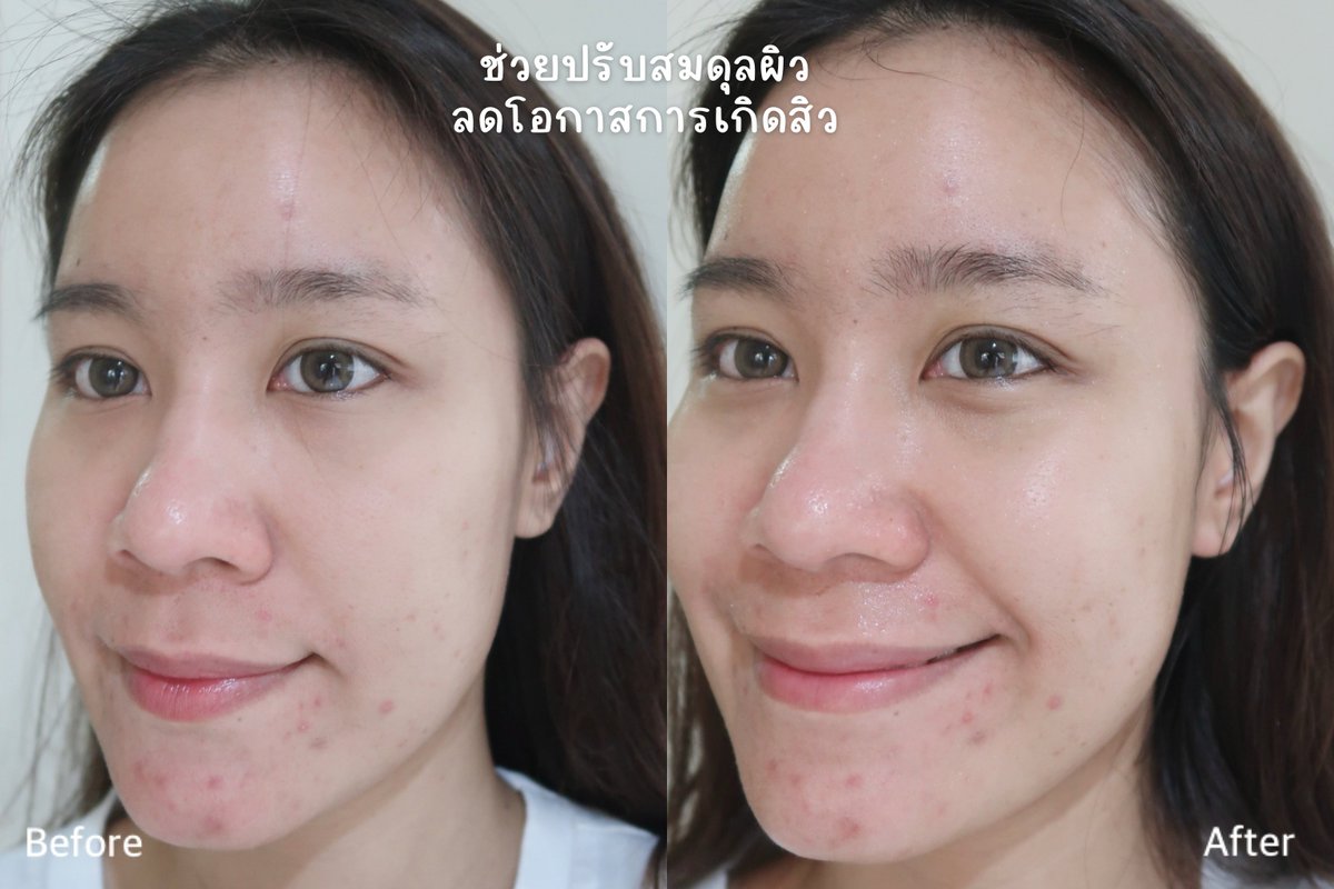 อะดิ๋วอิ๋วเอง🌷💫🌿 tweet media