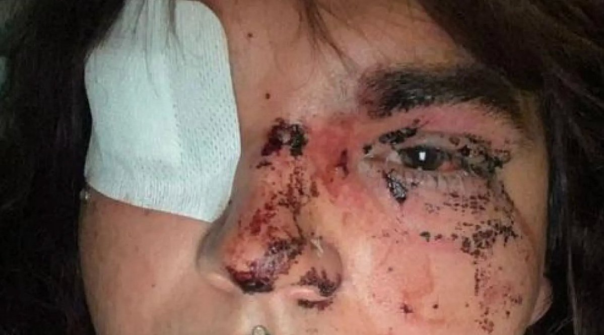 Pablo Echenique tweet media