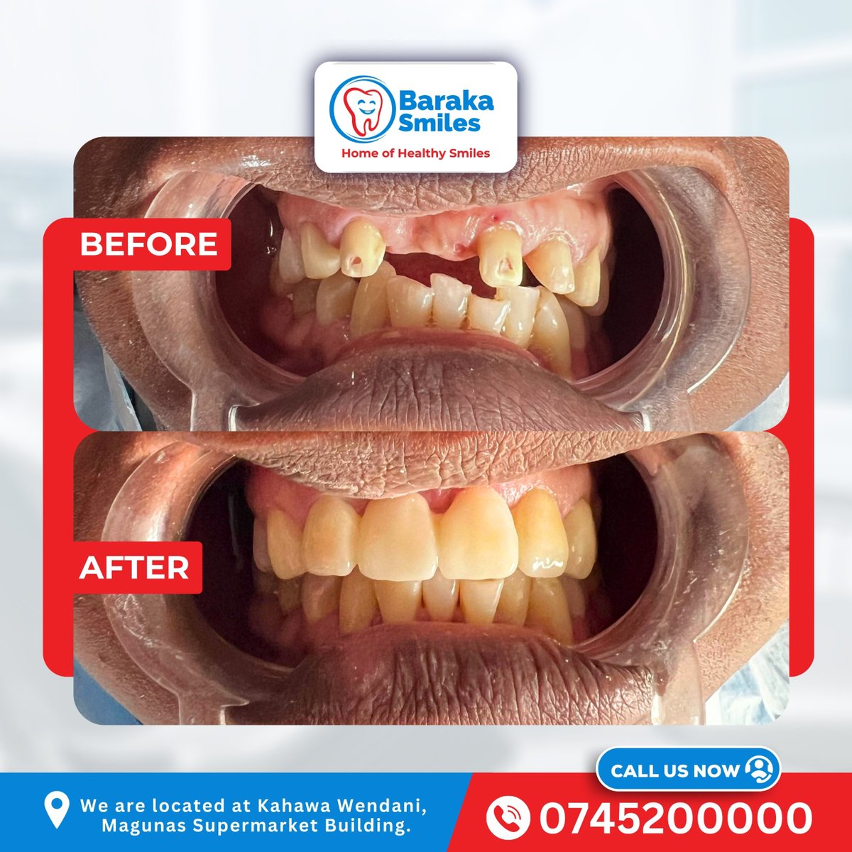 Baraka Smiles Dental Clinic tweet media